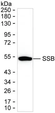 SSB Mouse Monoclonal Antibody - Size: 100µl