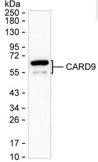 CARD9 Mouse Monoclonal Antibody - Size: 100µl