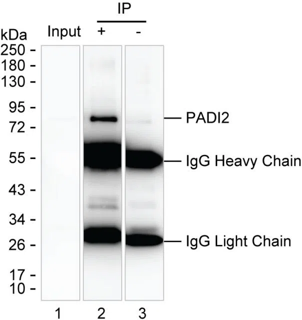 PADI2 Mouse Monoclonal Antibody - Size: 100µl