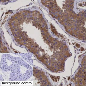 CEP290 Mouse Monoclonal Antibody - Size: 100µl