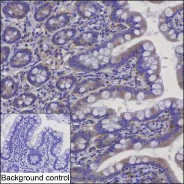 BLOC1S2 Mouse Monoclonal Antibody - Size: 100µl