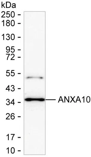 ANXA10 Mouse Monoclonal Antibody - Size: 100µl