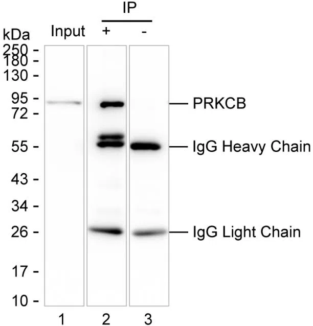 PRKCB Mouse Monoclonal Antibody - Size: 50µl