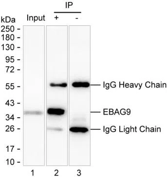 EBAG9 Mouse Monoclonal Antibody - Size: 100µl