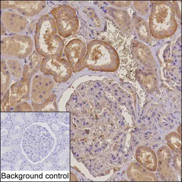 PIKFYVE Mouse Monoclonal Antibody - Size: 100µl