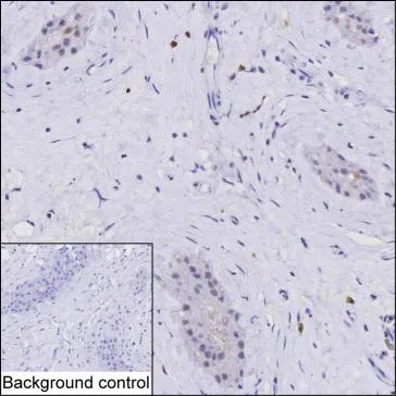 RNF6 Mouse Monoclonal Antibody - Size: 100µl