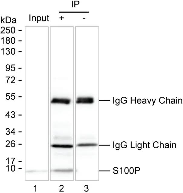 S100P Mouse Monoclonal Antibody - Size: 100µl