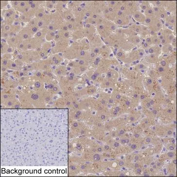 GSTT2B Mouse Monoclonal Antibody - Size: 100µl