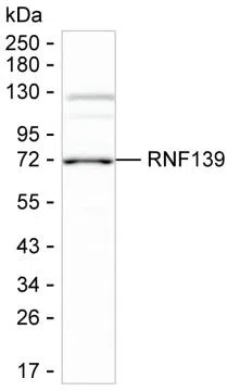 RNF139 Mouse Monoclonal Antibody - Size: 100µl