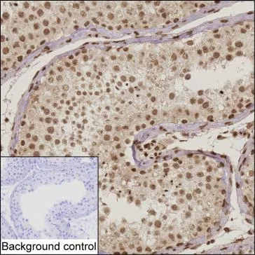 IL15 Mouse Monoclonal Antibody - Size: 50µl