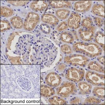 RARRES1 Mouse Monoclonal Antibody - Size: 100µl