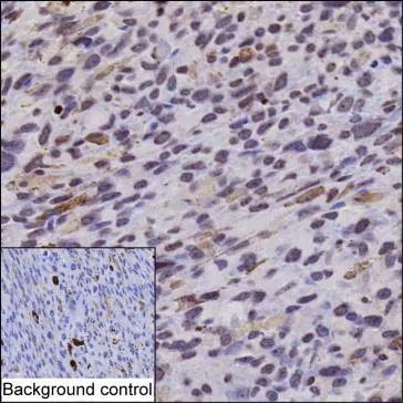 Mitf (phospho S157) Mouse Monoclonal Antibody - Size: 100µl