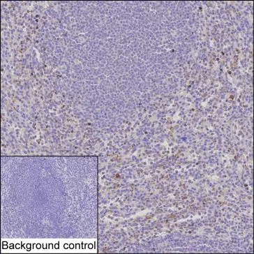 TNFRSF10C Mouse Monoclonal Antibody - Size: 100µl