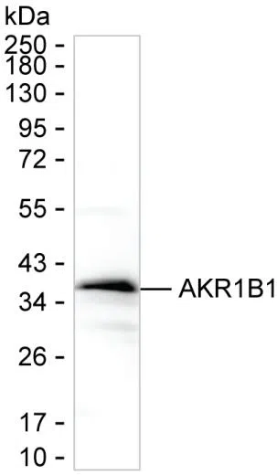 AKR1B1 Mouse Monoclonal Antibody - Size: 50µl