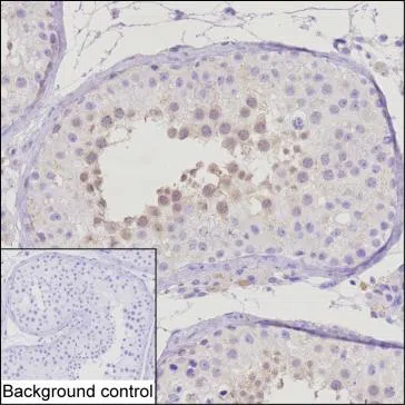 PPP1R2 Mouse Monoclonal Antibody - Size: 100µl