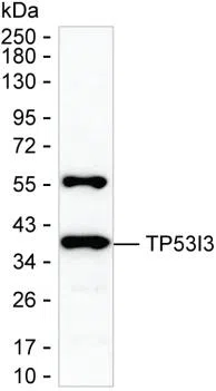 TP53I3 Mouse Monoclonal Antibody - Size: 100µl