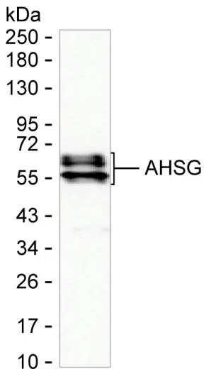 AHSG Mouse Monoclonal Antibody - Size: 100µl