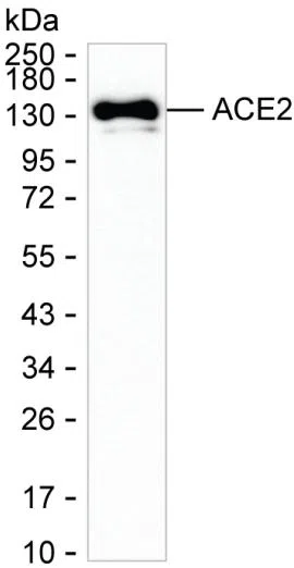 ACE2 Mouse Monoclonal Antibody - Size: 100µl