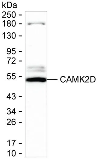 CAMK2D Mouse Monoclonal Antibody - Size: 50µl
