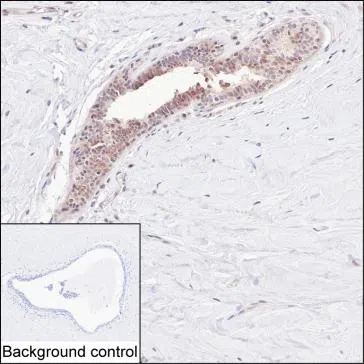 RNF113B Mouse Monoclonal Antibody - Size: 100µl