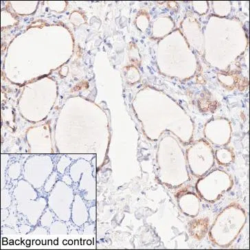 TSHR Mouse Monoclonal Antibody - Size: 100µl