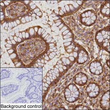CCL8 Mouse Monoclonal Antibody - Size: 100µl