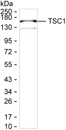 TSC1 Mouse Monoclonal Antibody - Size: 100µl