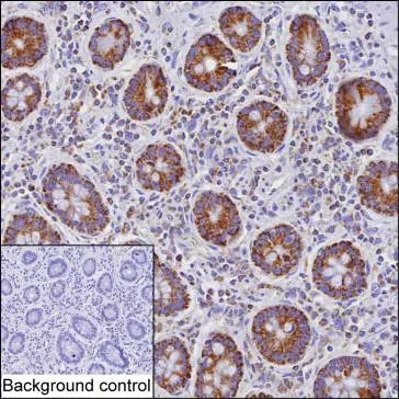 ETHE1 Mouse Monoclonal Antibody - Size: 50µl