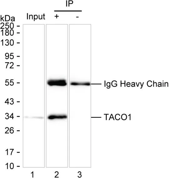 TACO1 Mouse Monoclonal Antibody - Size: 100µl