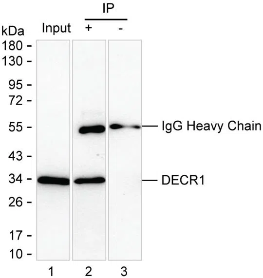 DECR1 Mouse Monoclonal Antibody - Size: 50µl