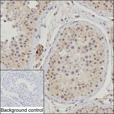 TRAIP Mouse Monoclonal Antibody - Size: 100µl