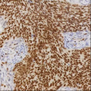 ZXDC Mouse Monoclonal Antibody - Size: 100µl