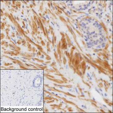 ACTG2 Mouse Monoclonal Antibody - Size: 100µl