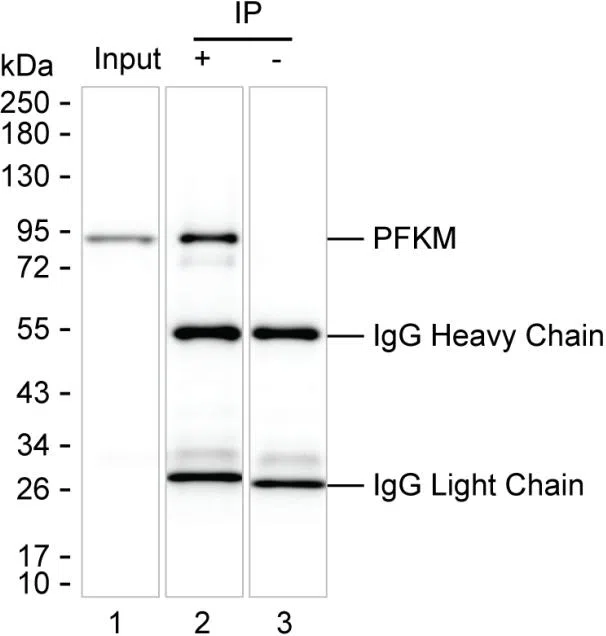 PFKM Mouse Monoclonal Antibody - Size: 50µl