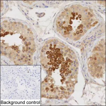 LZTFL1 Mouse Monoclonal Antibody - Size: 100µl
