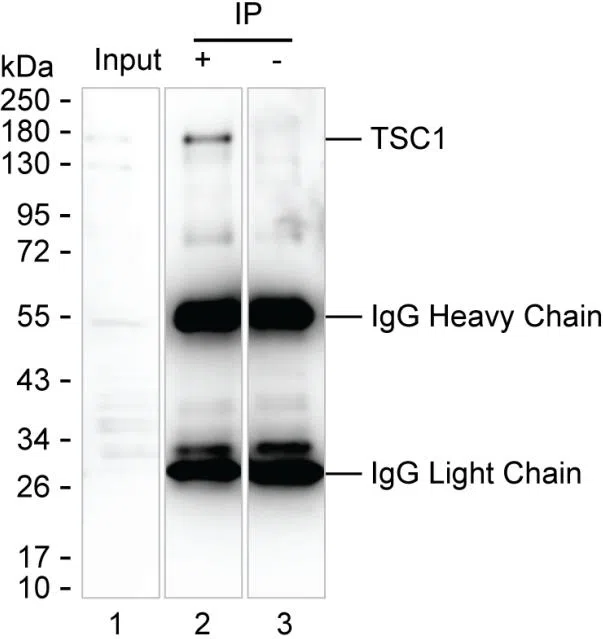 TSC1 Mouse Monoclonal Antibody - Size: 100µl