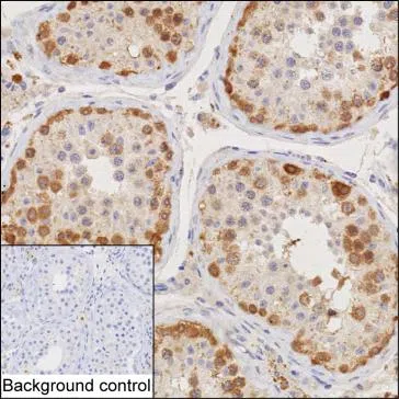 CTAG1A Mouse Monoclonal Antibody - Size: 100µl