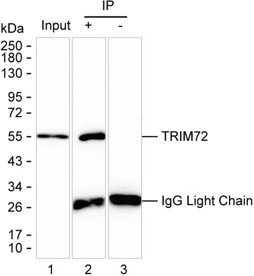 TRIM72 Mouse Monoclonal Antibody - Size: 100µl
