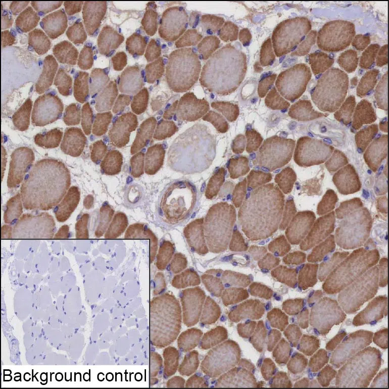 NT5C1A Mouse Monoclonal Antibody - Size: 100µl