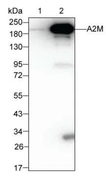 A2M Mouse Monoclonal Antibody - Size: 100µl