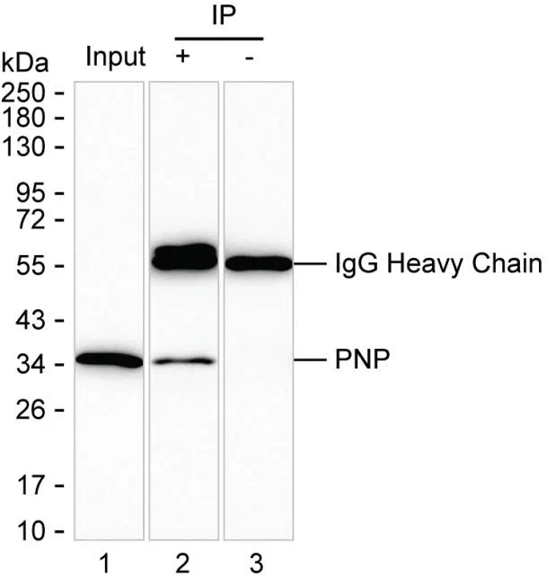 PNP Mouse Monoclonal Antibody - Size: 100µl