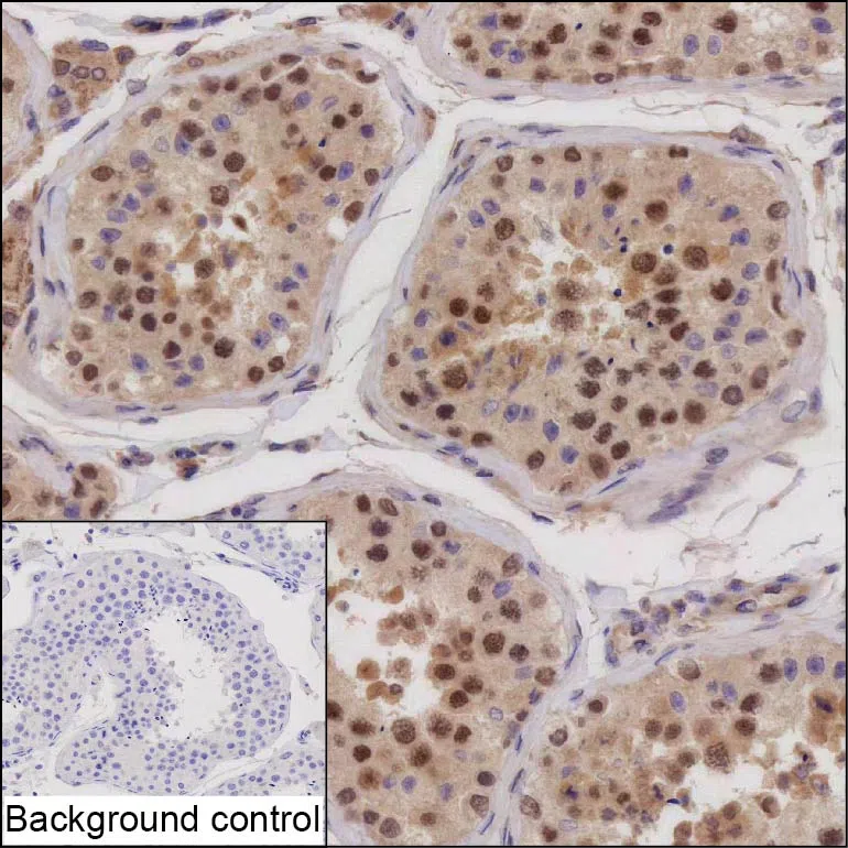 BABAM1 Mouse Monoclonal Antibody - Size: 100µl