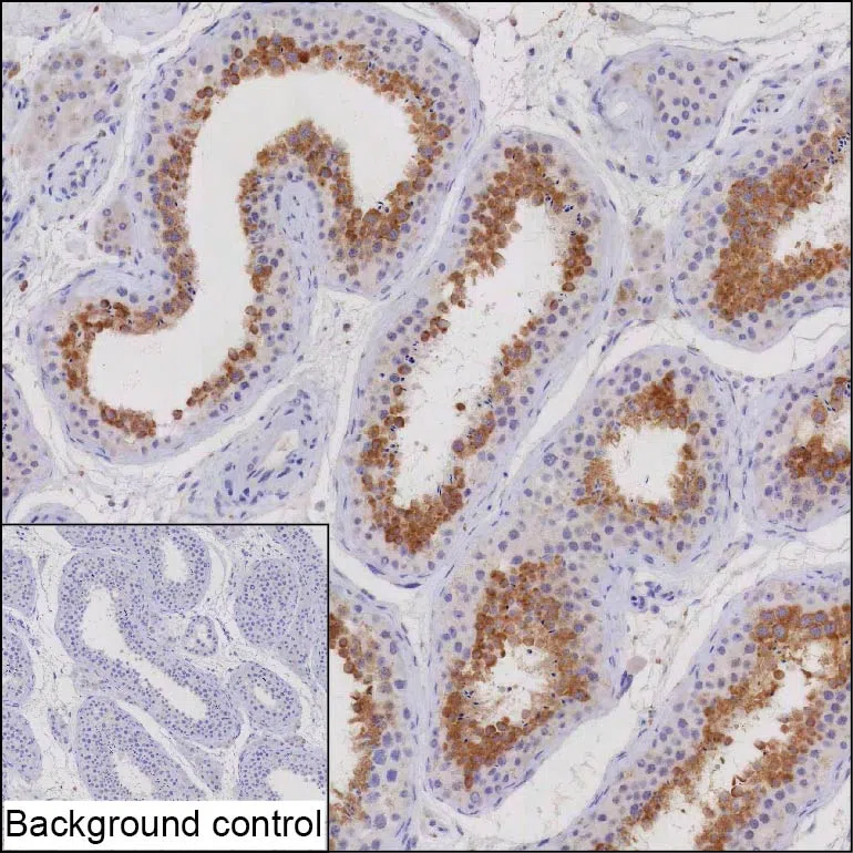 CLTCL1 Mouse Monoclonal Antibody - Size: 100µl