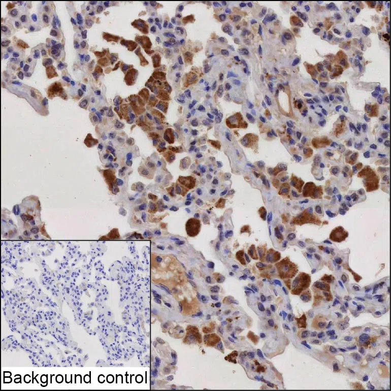 HPGDS Mouse Monoclonal Antibody - Size: 50µl
