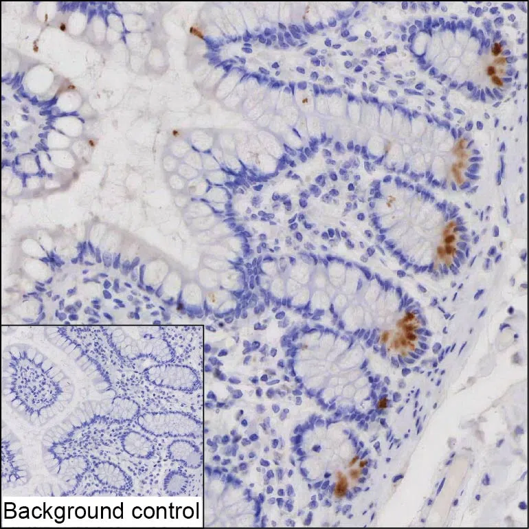 GUCA2A Mouse Monoclonal Antibody - Size: 100µl