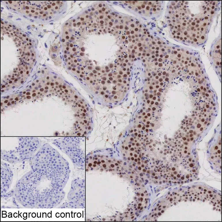 VRK1 Mouse Monoclonal Antibody - Size: 50µl