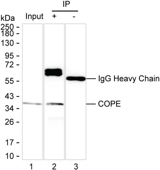 COPE Mouse Monoclonal Antibody - Size: 50µl