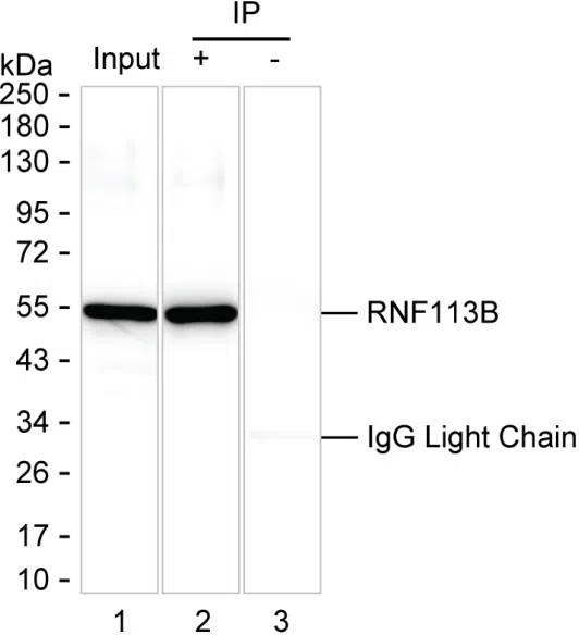 RNF113B Mouse Monoclonal Antibody - Size: 100µl