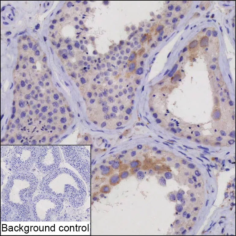 CXorf49 Mouse Monoclonal Antibody - Size: 50µl