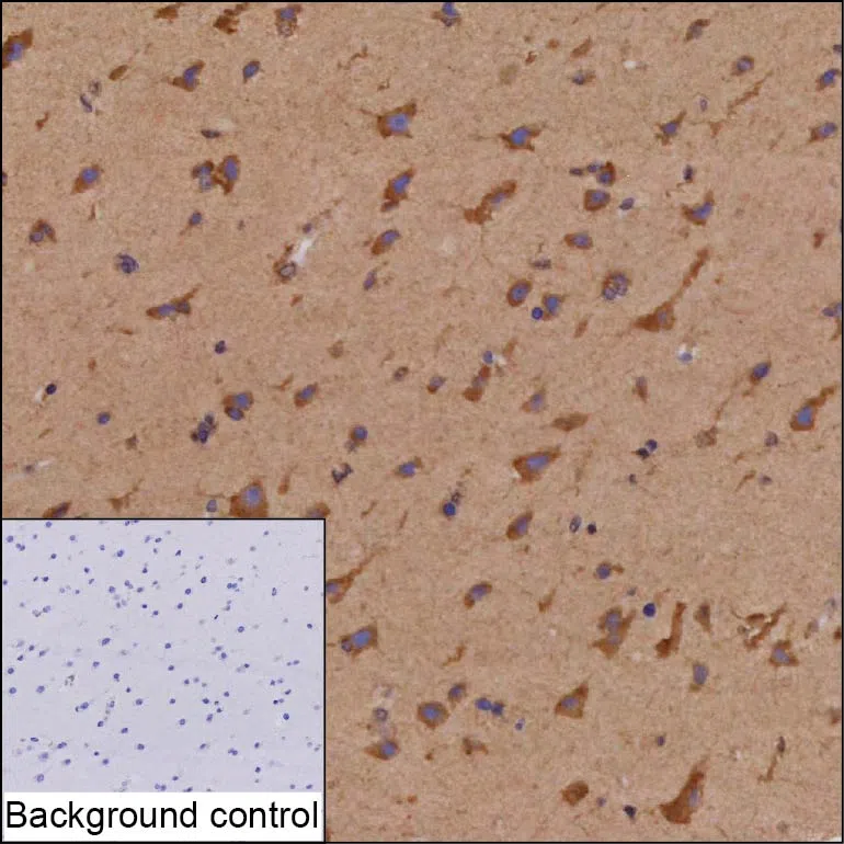 TTC3 Mouse Monoclonal Antibody - Size: 100µl